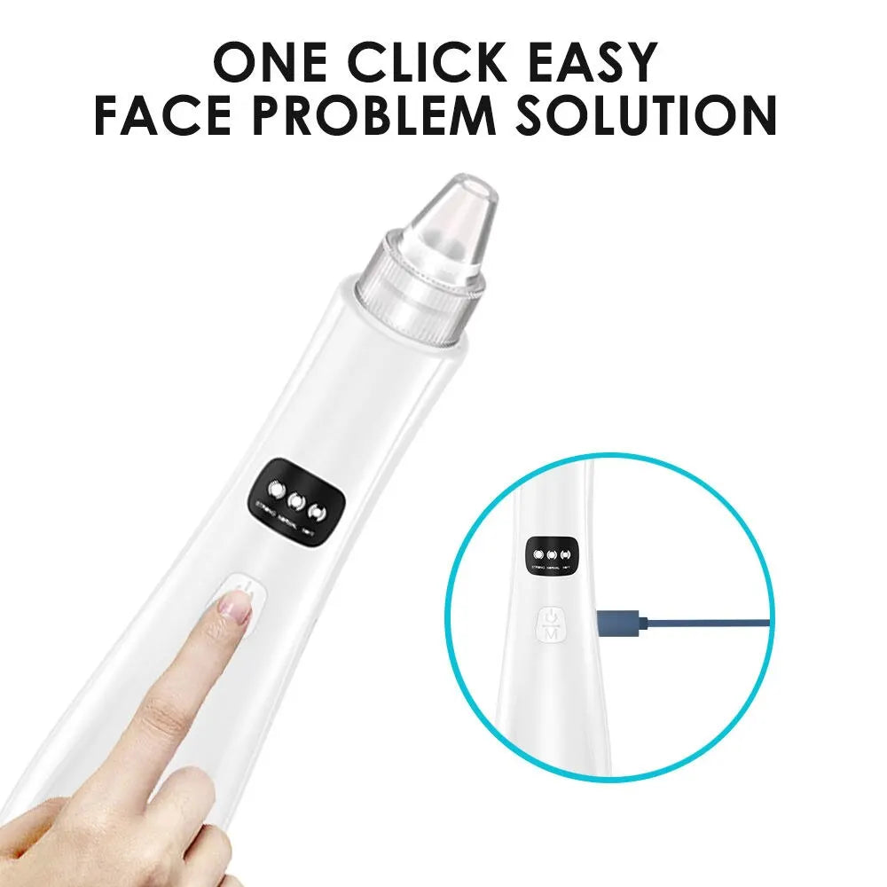 3-Mode Face Vacuum Blackhead Remover – Deep Cleansing Beauty Device