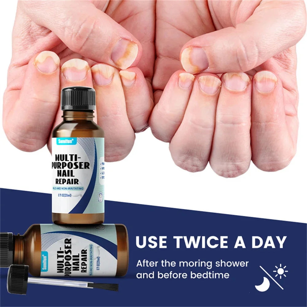 Fungal Nail Treatment Serum – Anti-Fungal & Nail Repair Essence Info Draft Submit Title