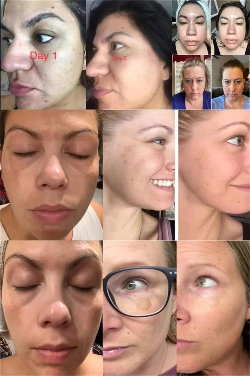 Brightening face cream-Reduce dark spots