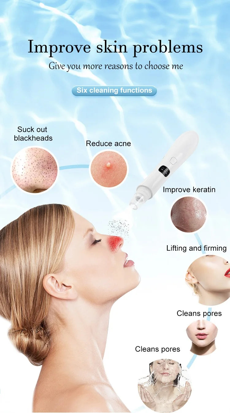 3-Mode Face Vacuum Blackhead Remover – Deep Cleansing Beauty Device