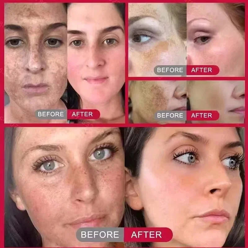 Brightening face cream-Reduce dark spots