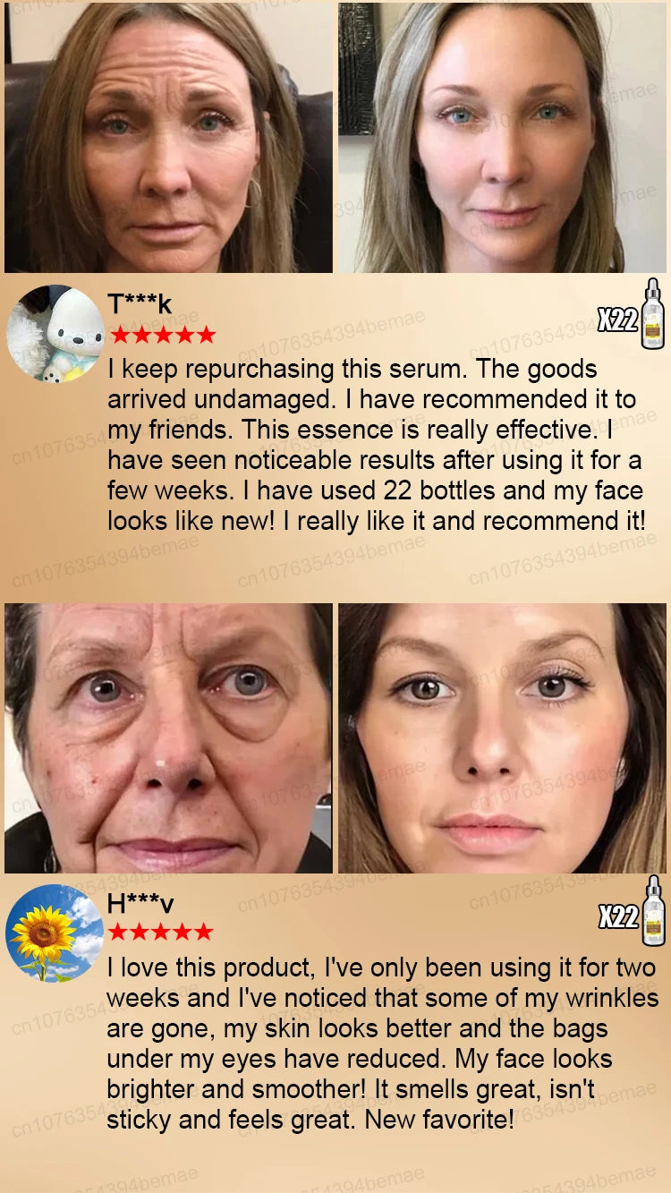 Anti-aging serum Wrinkles fade. Beauty stays.