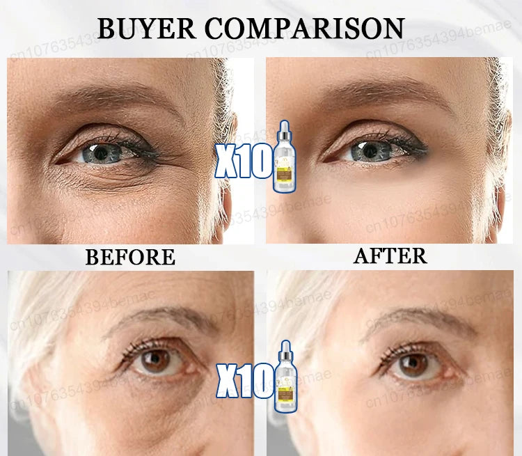 Anti-aging serum Wrinkles fade. Beauty stays.