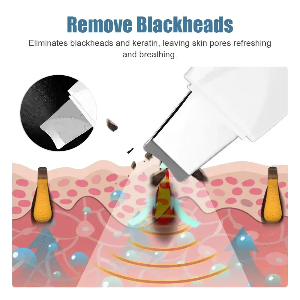 Deep Vibrating Facial Scrubber – Blackhead Remover & Skin Peeling Spatula
