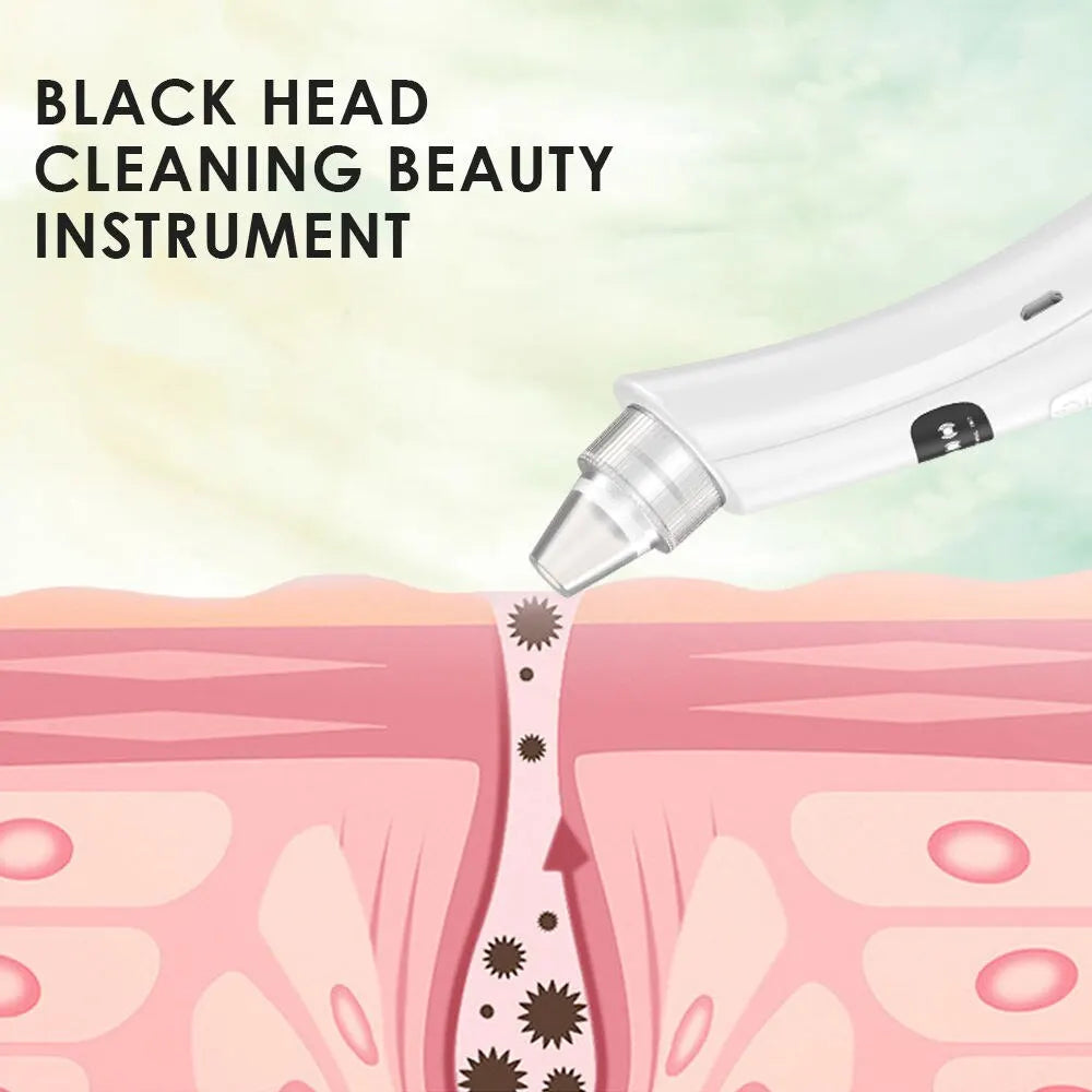 3-Mode Face Vacuum Blackhead Remover – Deep Cleansing Beauty Device