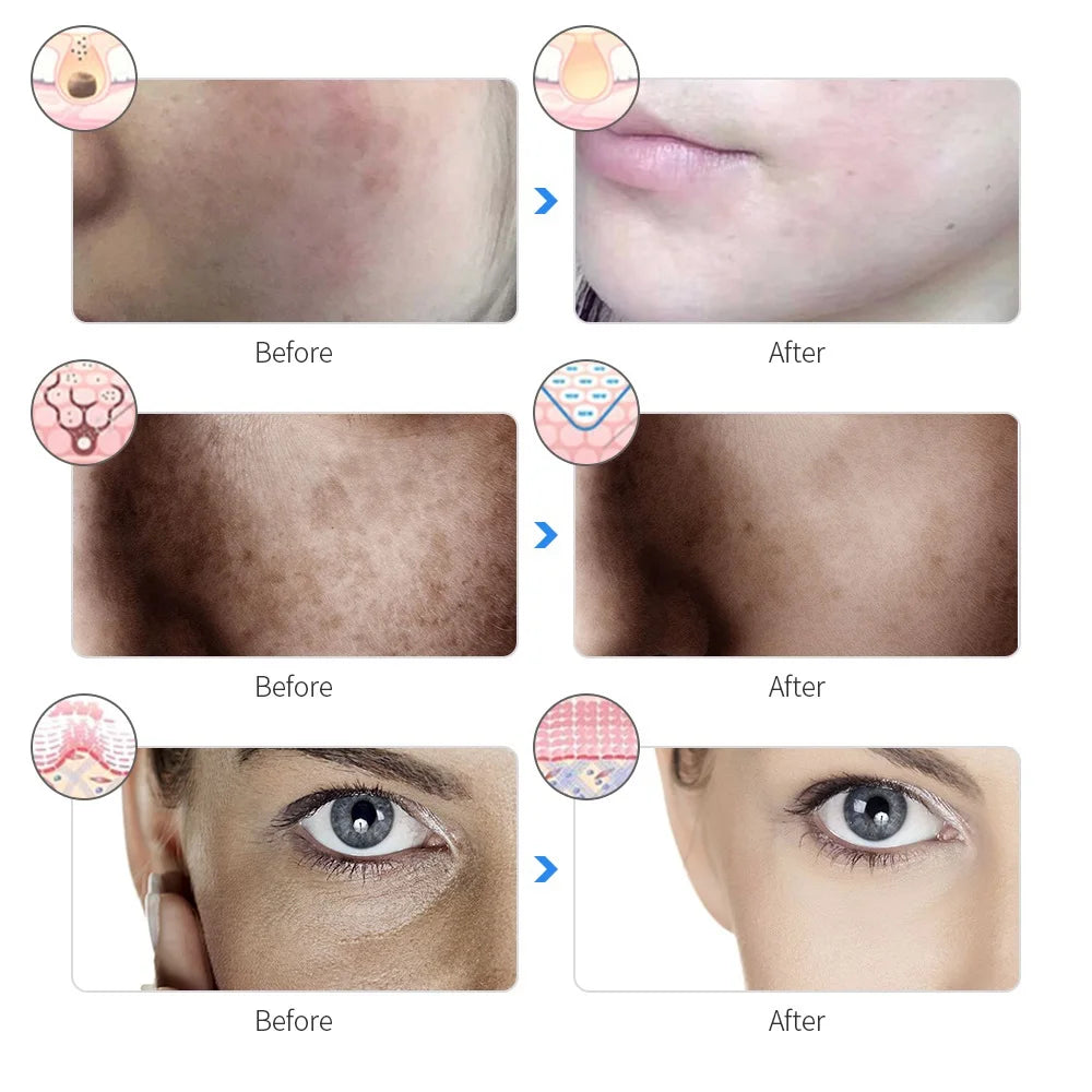 Rechargeable 7-Color LED Facial Mask – Skin Rejuvenation & Acne Treatment