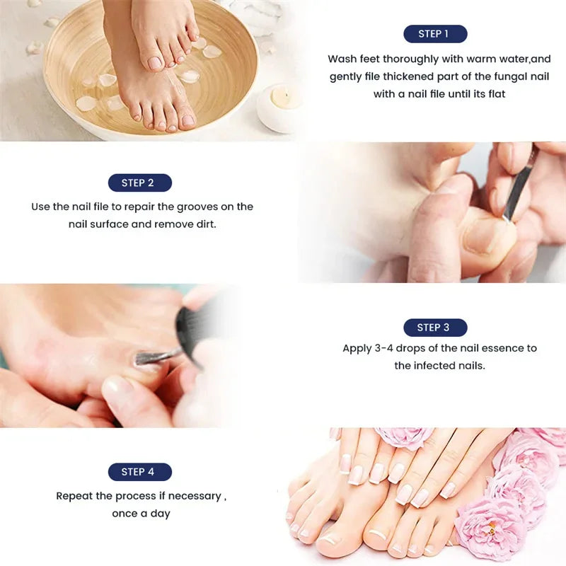 Fungal Nail Treatment Serum – Anti-Fungal & Nail Repair Essence Info Draft Submit Title