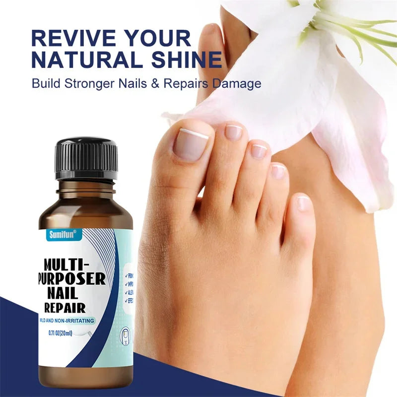 Fungal Nail Treatment Serum – Anti-Fungal & Nail Repair Essence Info Draft Submit Title