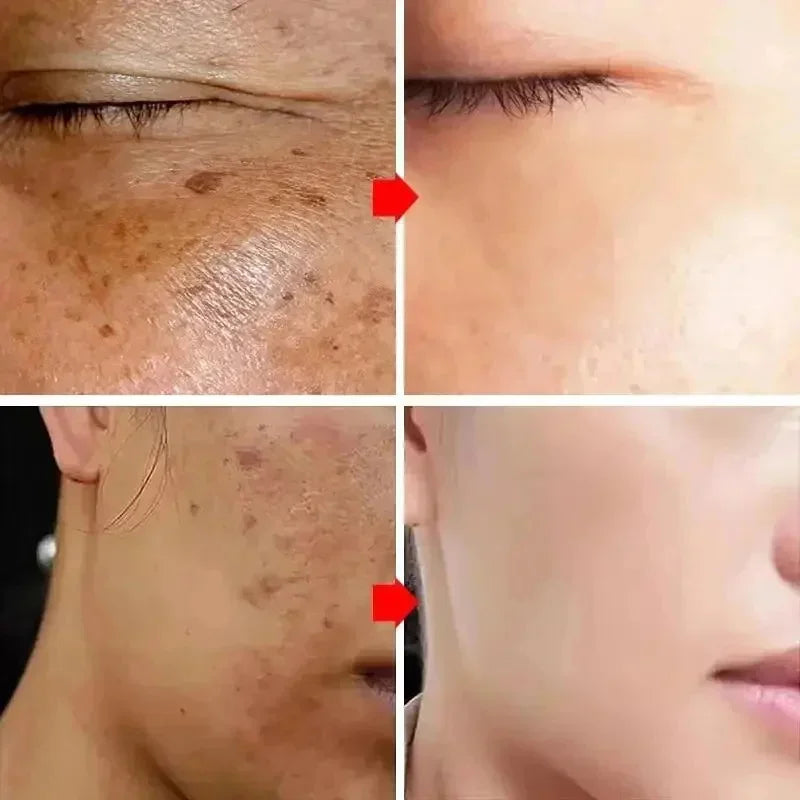 Brightening face cream-Reduce dark spots