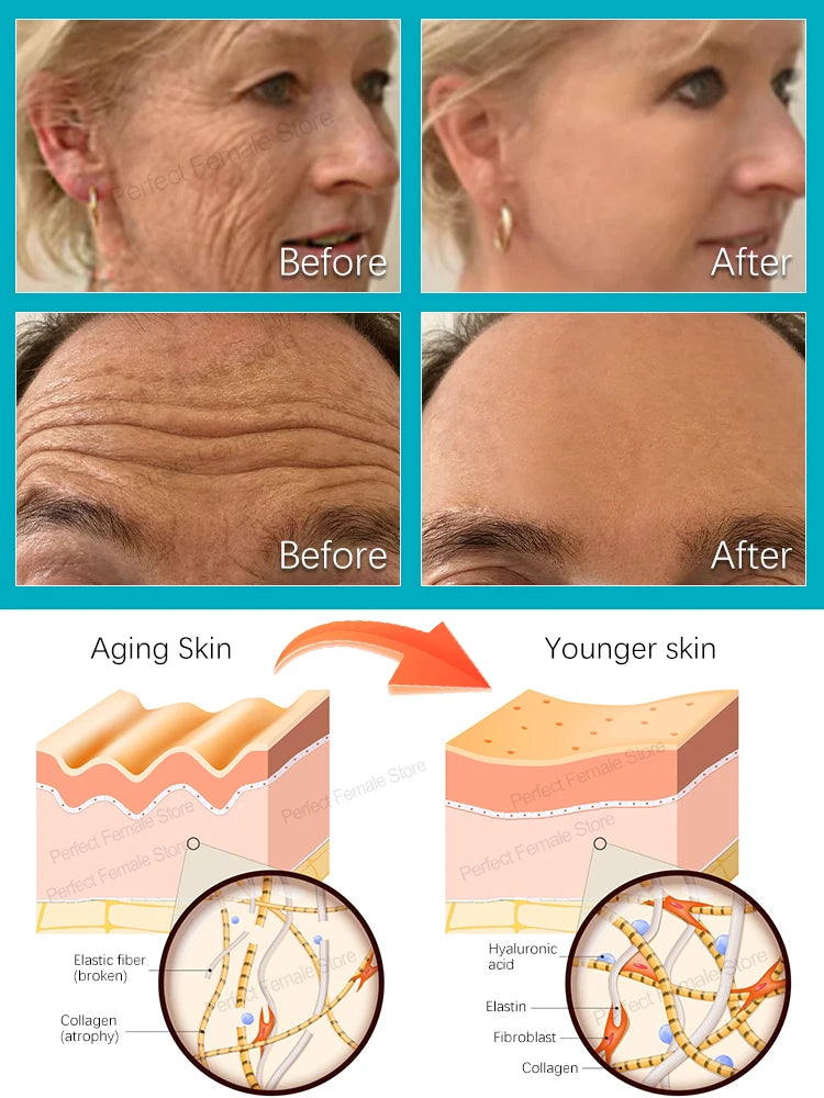 Anti-aging serum Wrinkles fade. Beauty stays.