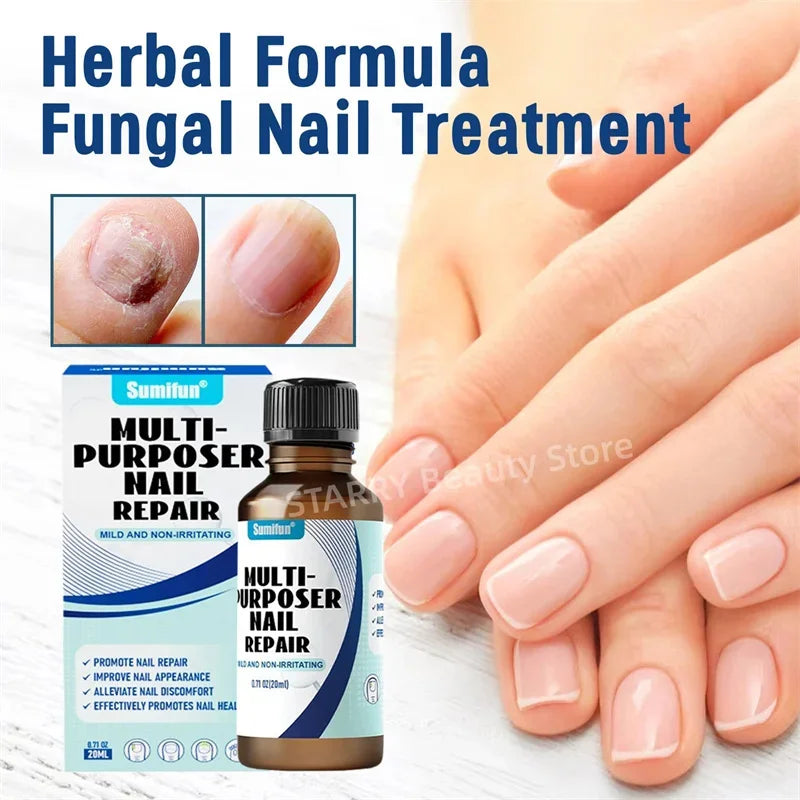 Fungal Nail Treatment Serum – Anti-Fungal & Nail Repair Essence Info Draft Submit Title