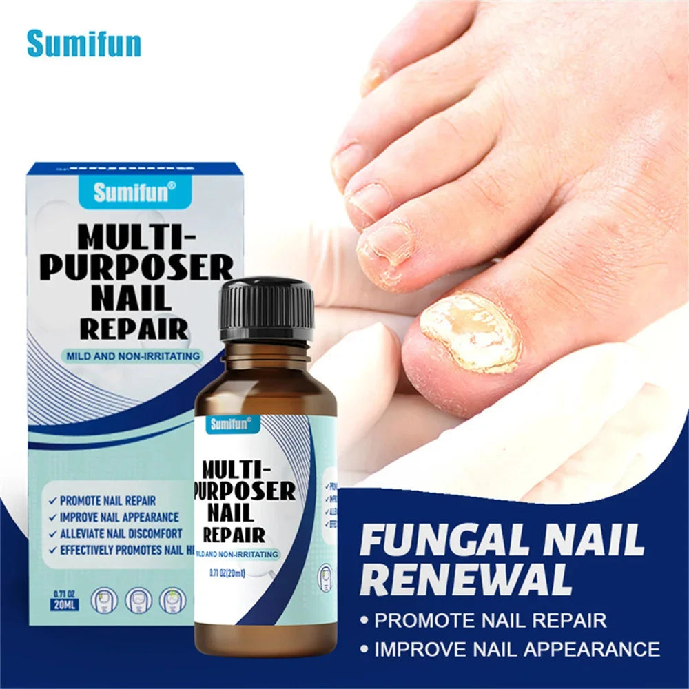 Fungal Nail Treatment Serum – Anti-Fungal & Nail Repair Essence Info Draft Submit Title