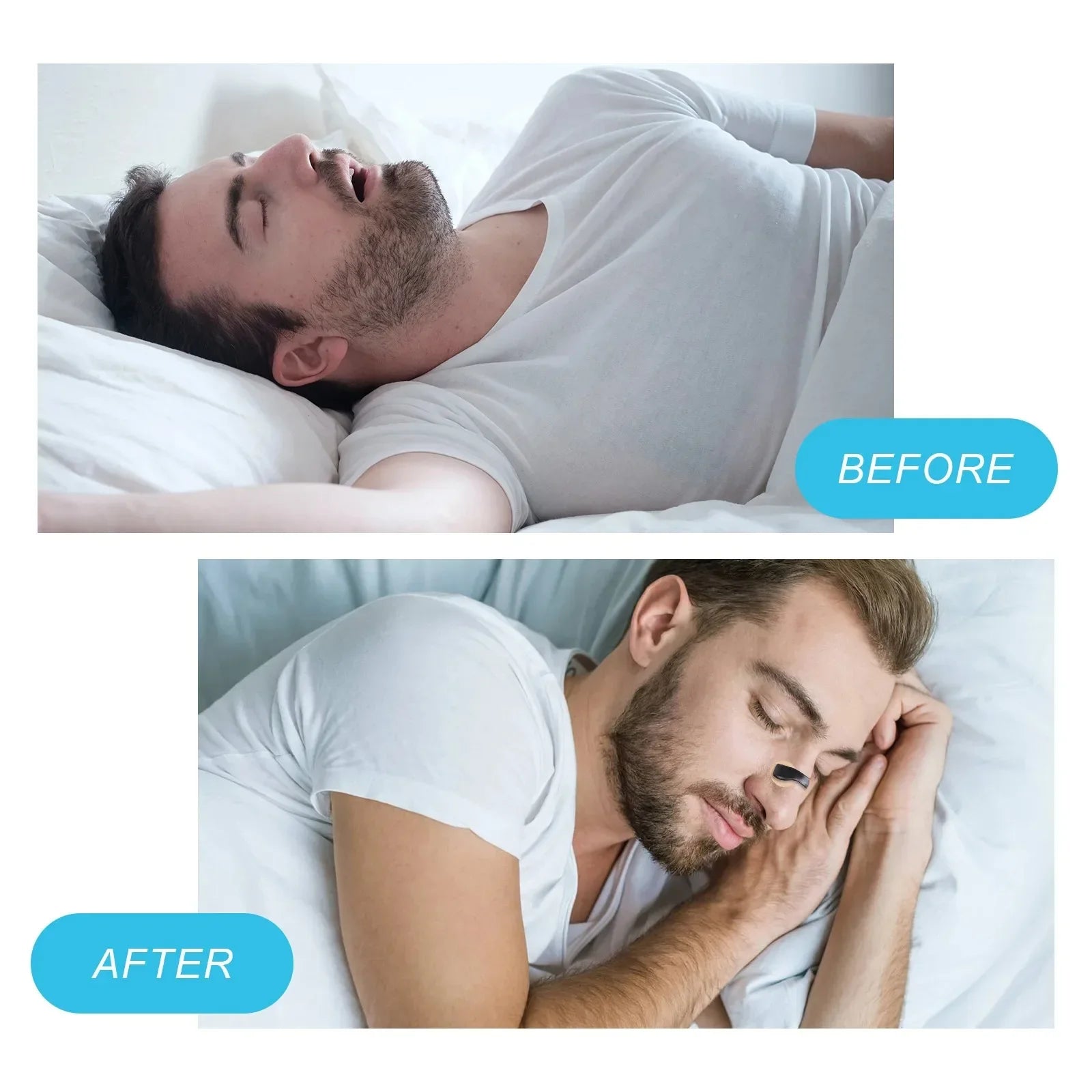Anti-snoring Nose Clip Nasal Breathing Dilators Starter Kits: