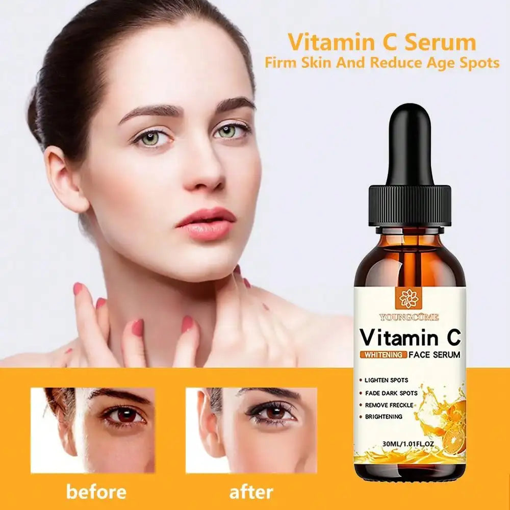 Vitamin C Facial Essence – 30ml Dark Spot Remover & Anti-Aging Serum