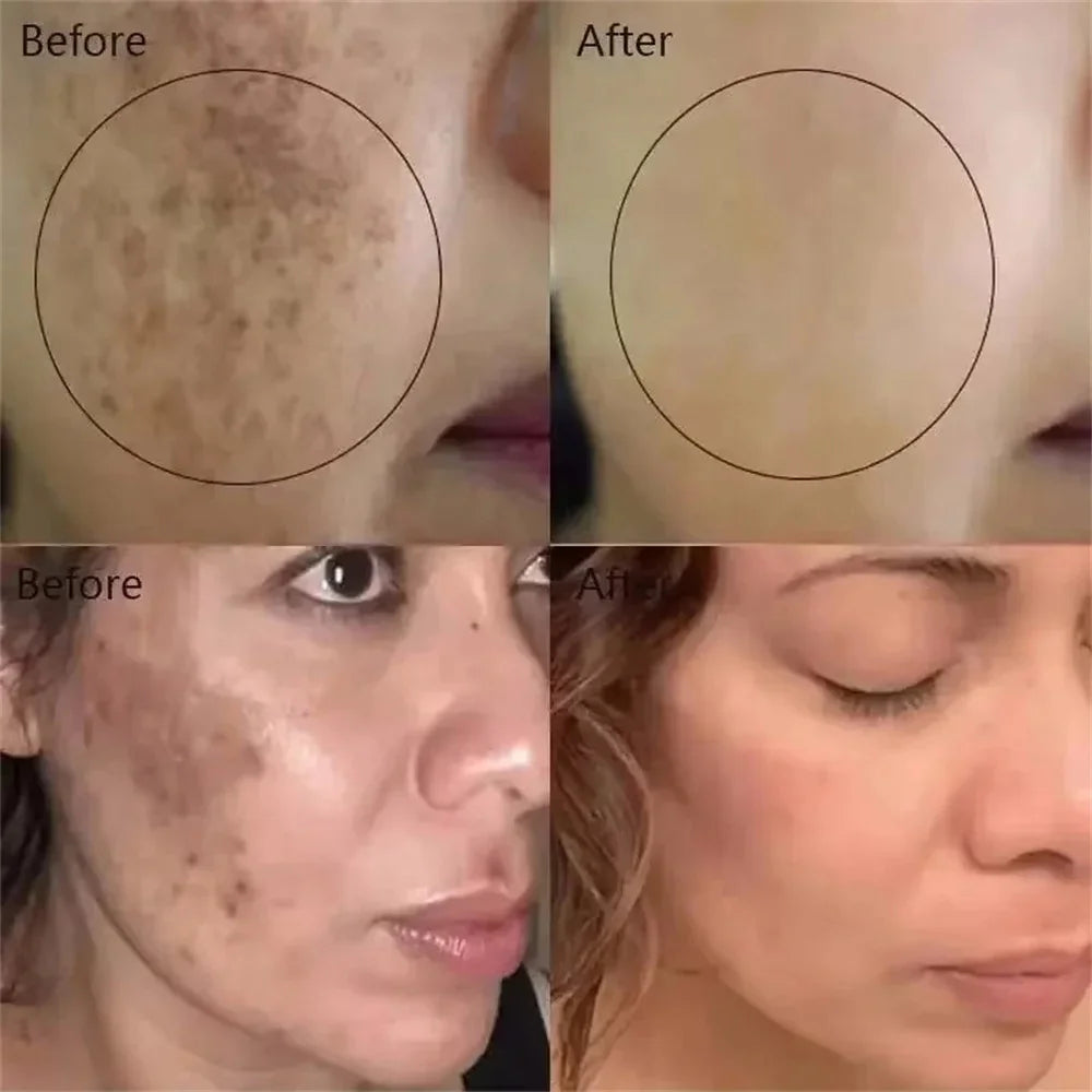 Brightening face cream-Reduce dark spots