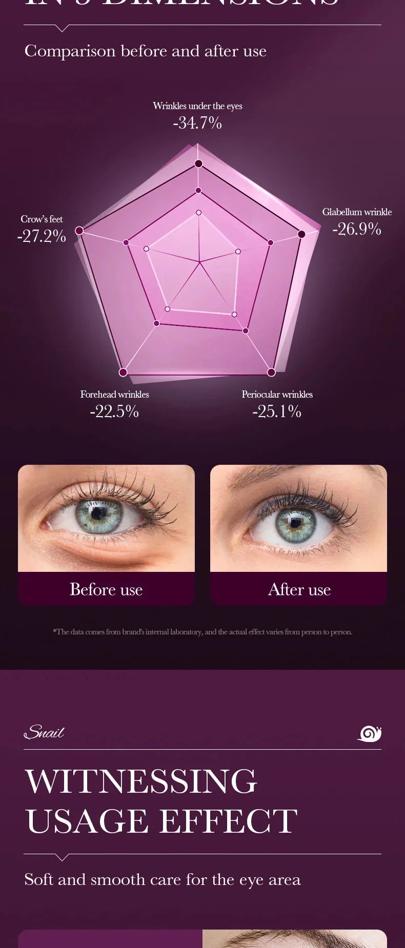 Snail Collagen Eye Cream – Anti-Aging, Dark Circles & Puffiness Care