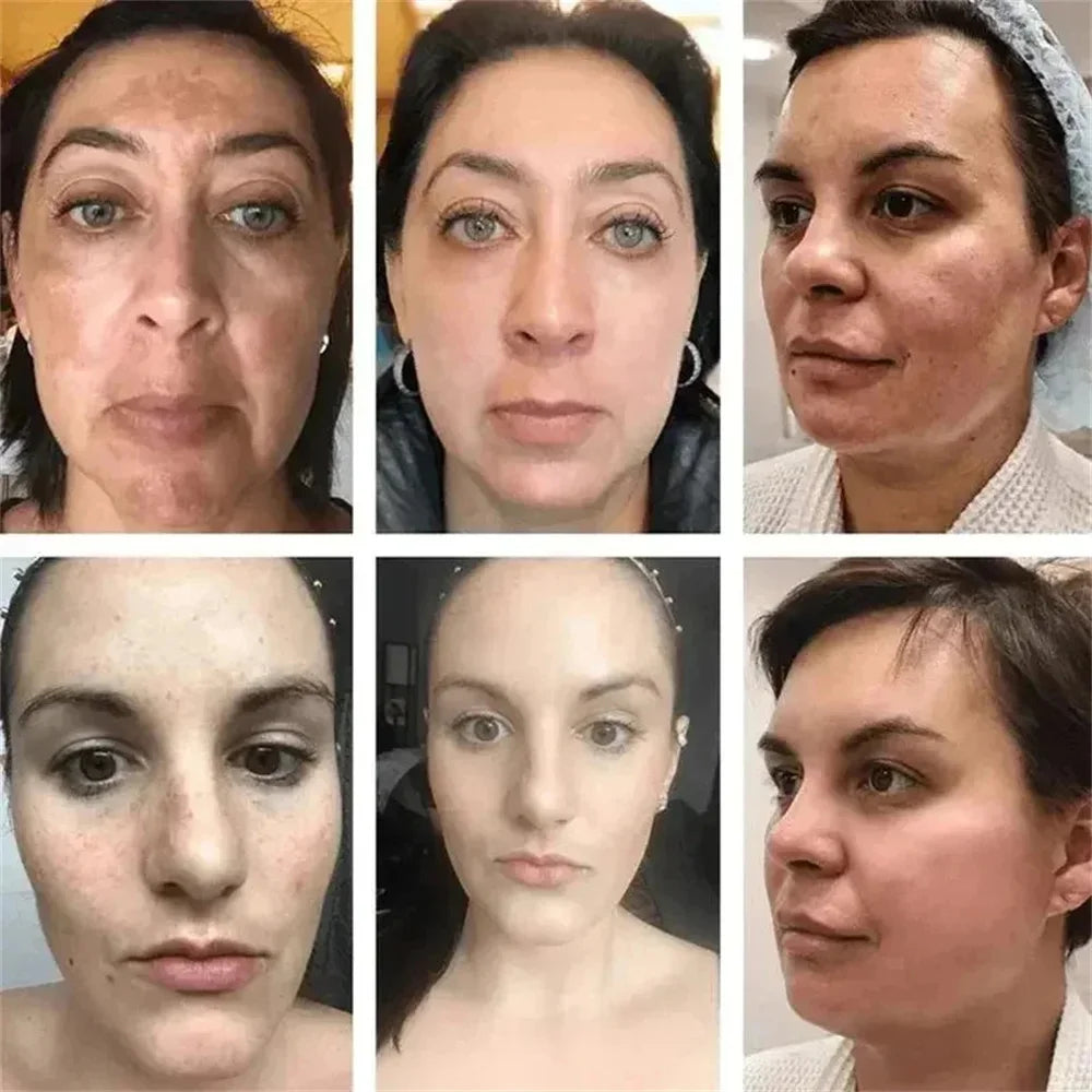Brightening face cream-Reduce dark spots