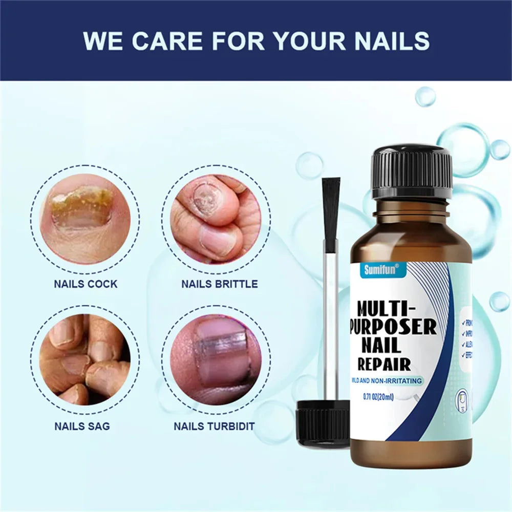 Fungal Nail Treatment Serum – Anti-Fungal & Nail Repair Essence Info Draft Submit Title
