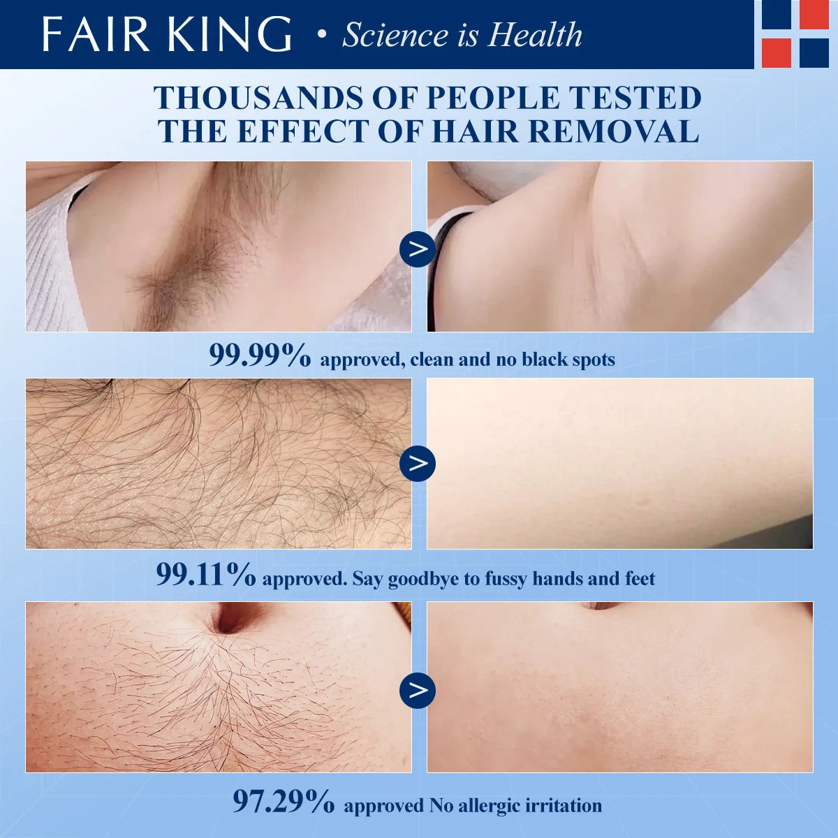 KING Herbal Hair RemFAIRoval Cream – 40g