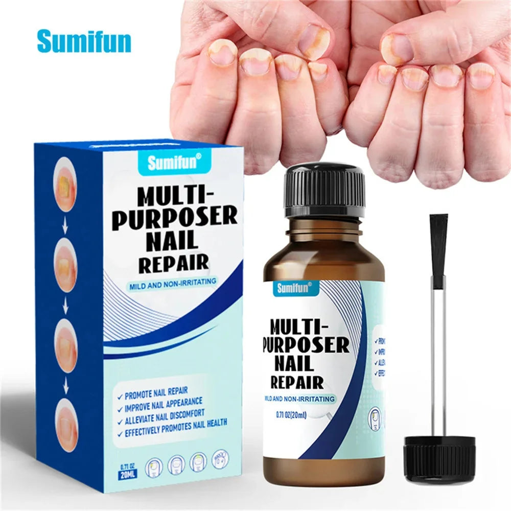 Fungal Nail Treatment Serum – Anti-Fungal & Nail Repair Essence Info Draft Submit Title
