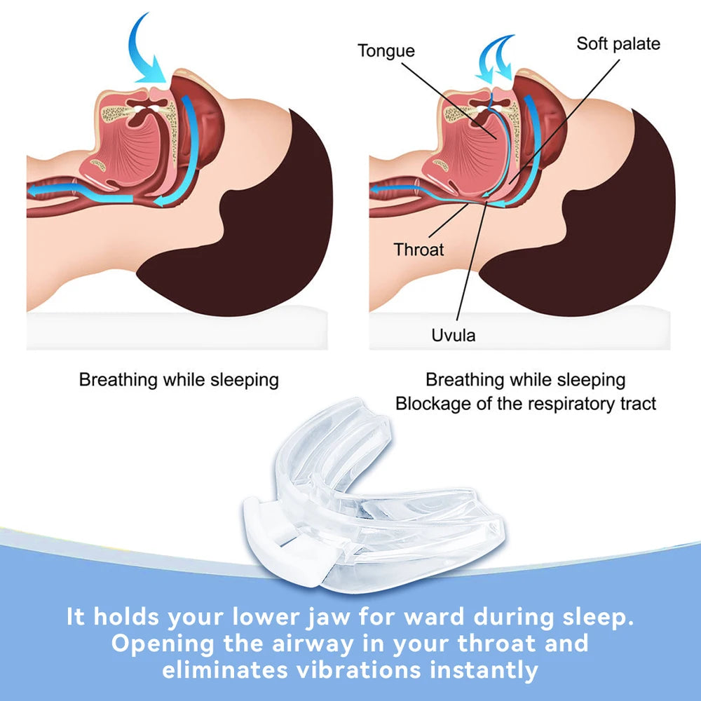 Adjustable Anti Snoring Mouth Guard Braces Sleeping Anti-Snoring Devices Bruxism Improve Sleep Snore Mouthpiece