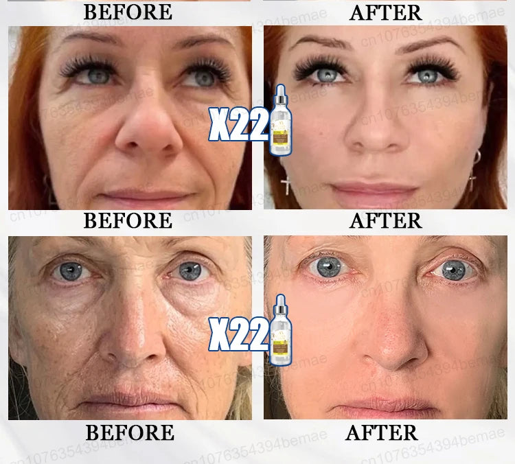 Anti-aging serum Wrinkles fade. Beauty stays.