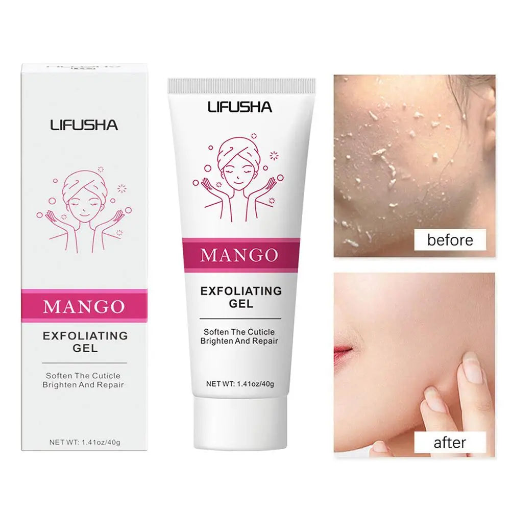 Aloe Vera Exfoliating Gel – Blackhead Remover & Pore Minimizer (30g–100g)